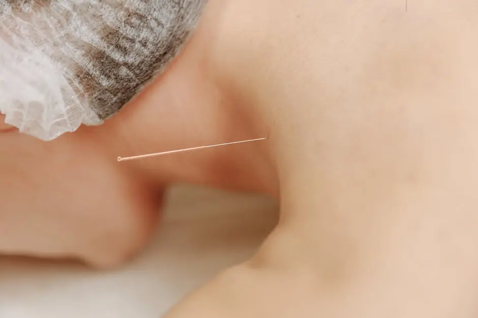 Detailed close-up image of an acupuncture needle inserted into skin, showcasing traditional Chinese medicine.