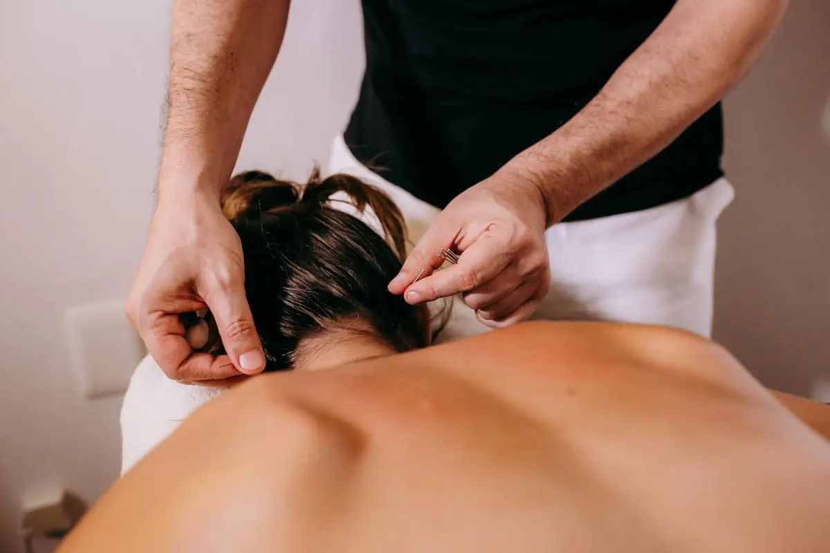 A professional performs acupuncture therapy on a woman’s back for relaxation and wellbeing.