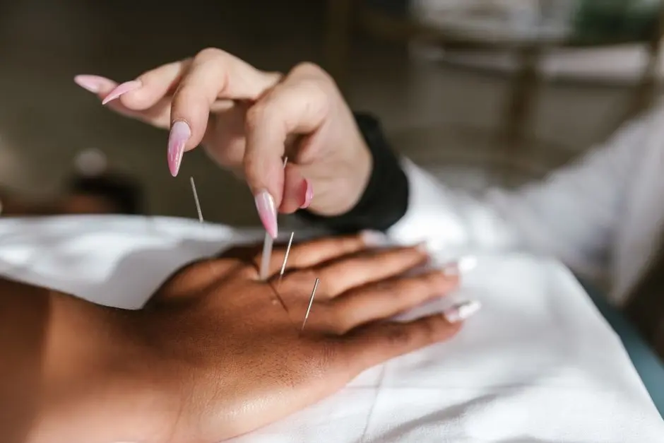 A detailed view of an acupuncture session for holistic health and wellness.