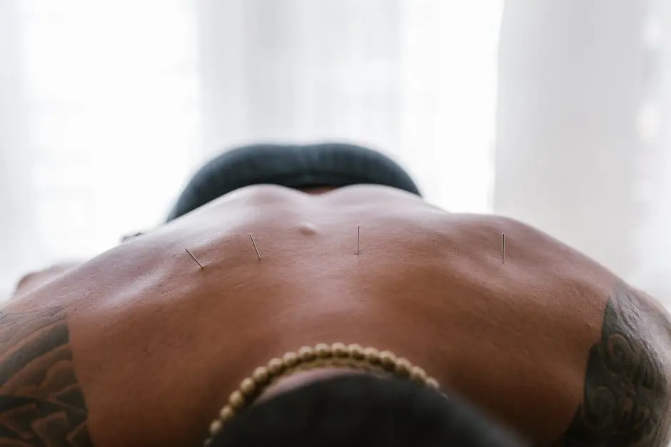 Close-up image of acupuncture needles applied to a person’s back during treatment.