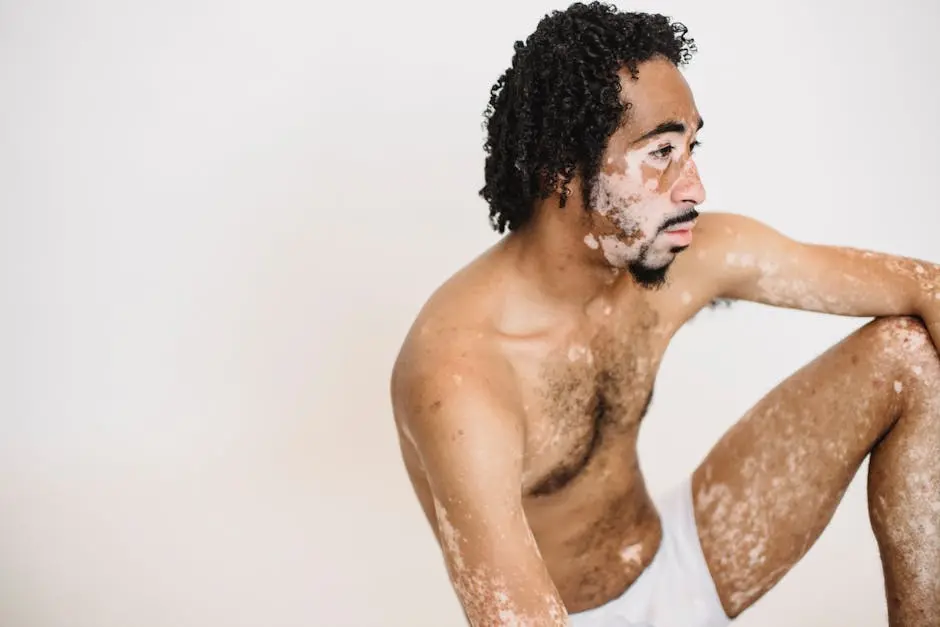 Young pensive unshaven African American male in underwear with vitiligo skin condition looking away