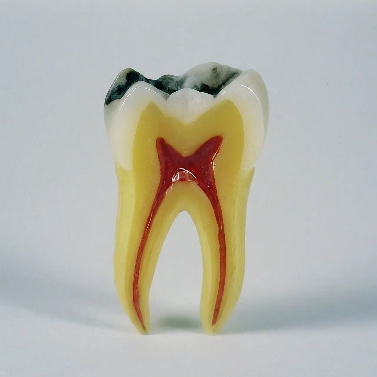A broken tooth isolated on a white background. 35mm stock photo