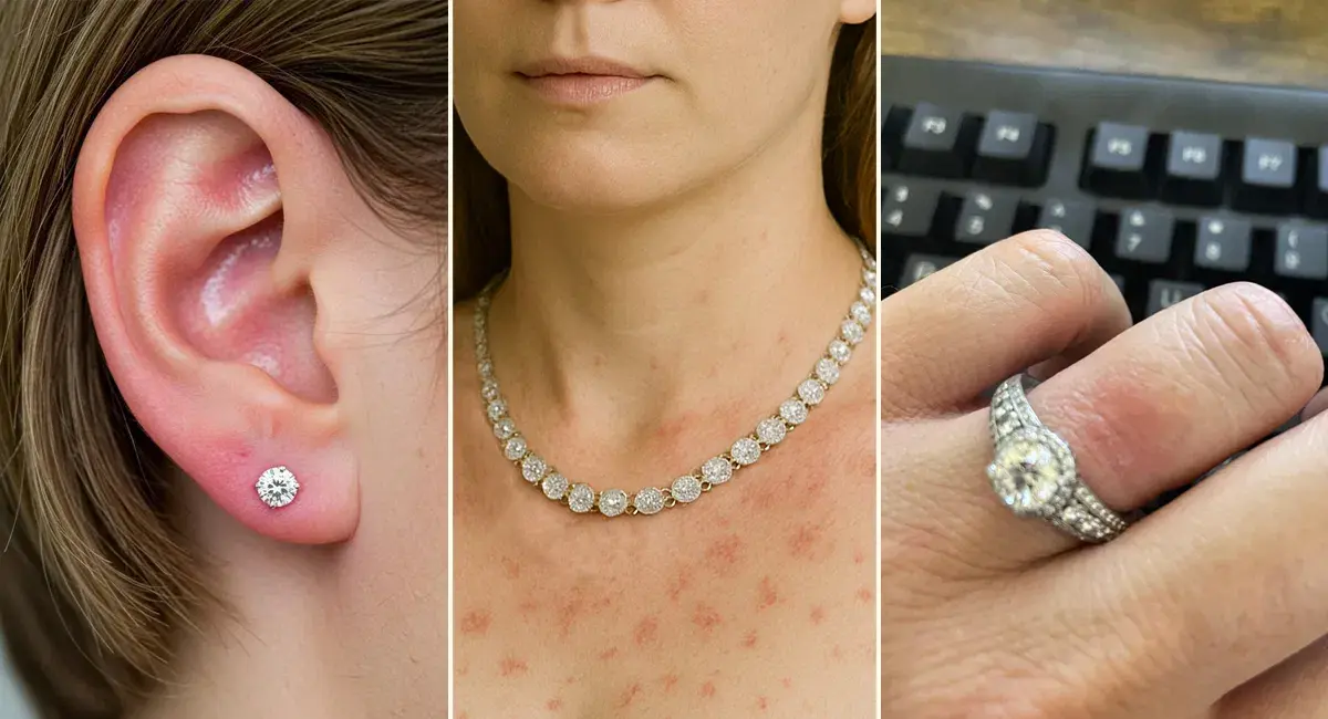 hypoallergenic jewelry