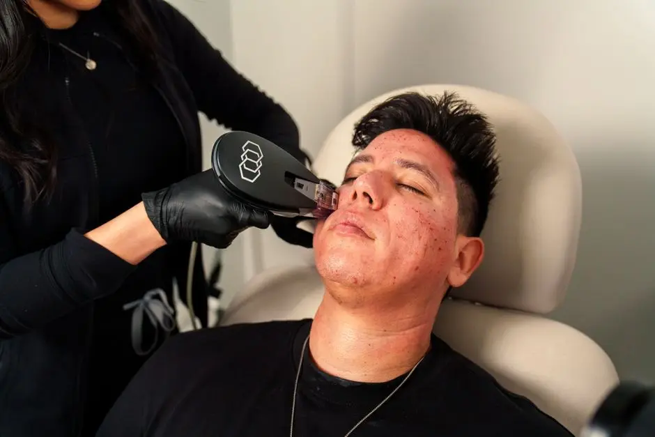 Man receives Morpheus8 facial treatment in Santa Ana med spa for skincare rejuvenation.